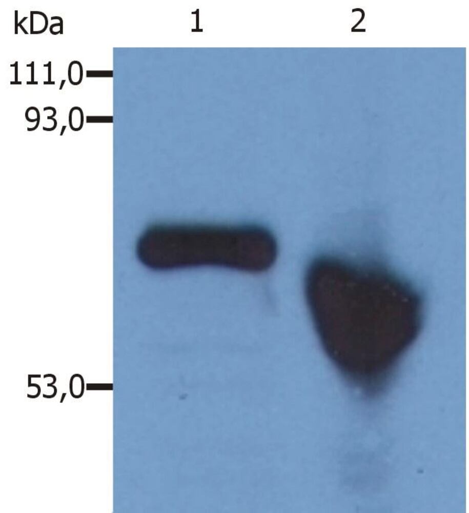 Anti-alpha Fetoprotein Antibody [AFP-01], 100 µg - Luminix Health