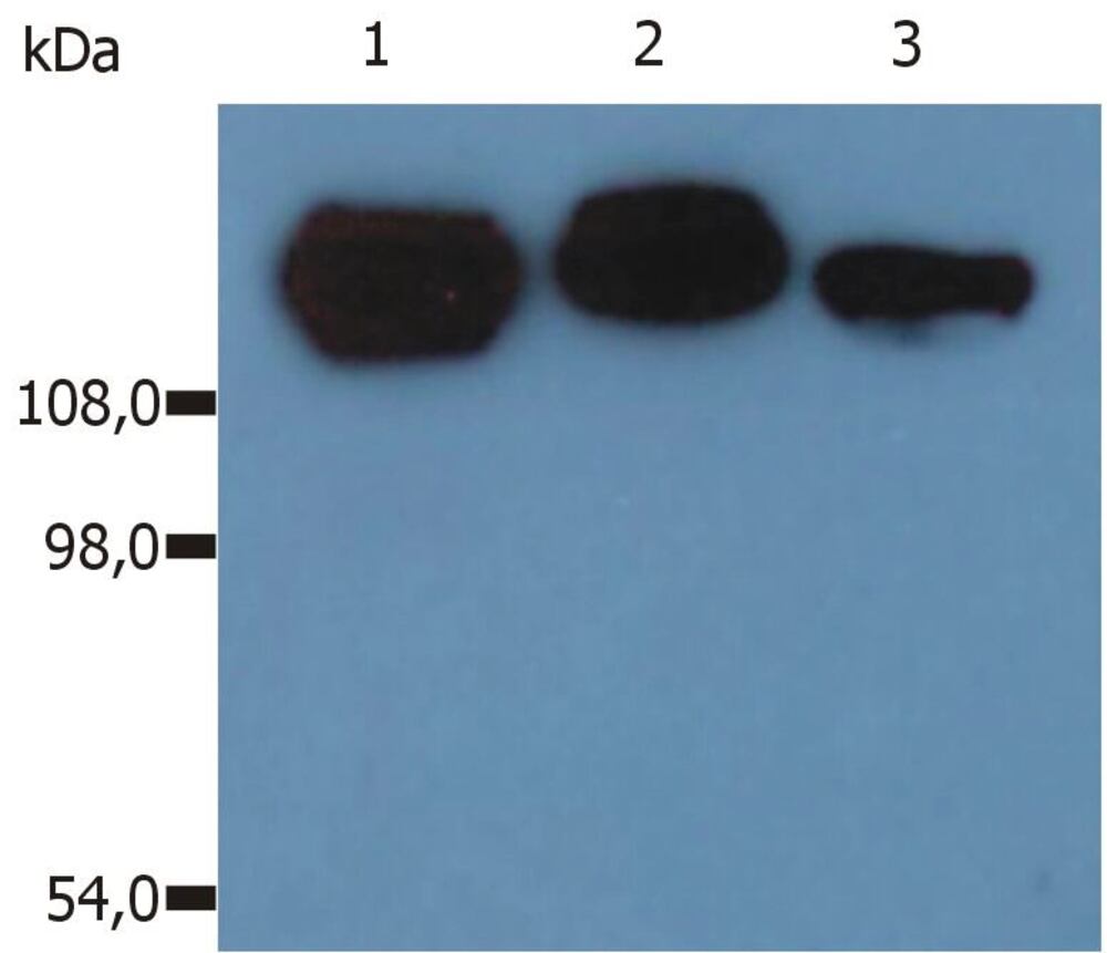 Anti-Integrin beta 1 Antibody [MEM-101A], 100 µg - Luminix Health