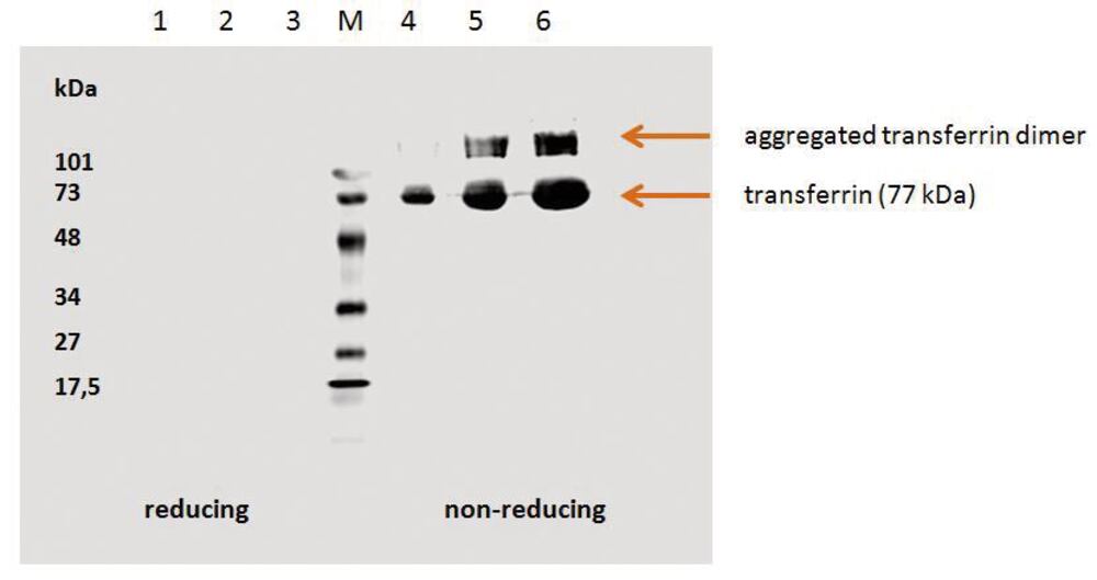 Anti-Transferrin Antibody [HTF-14], 100 µg - Luminix Health