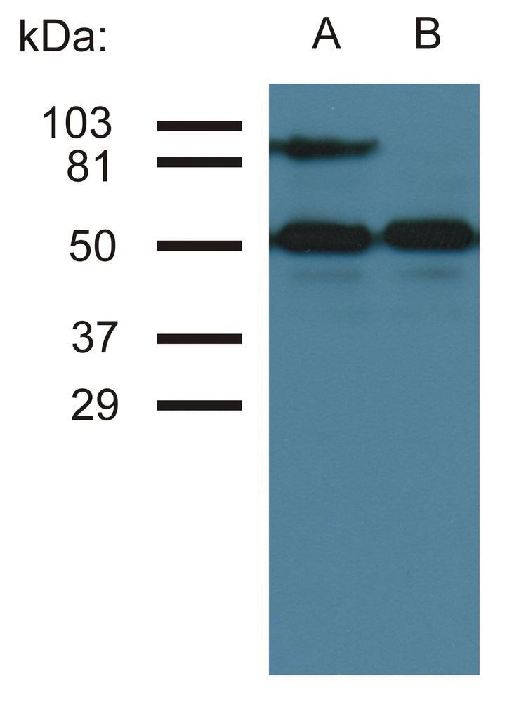 Anti-ICAM1 Antibody [MEM-111], 100 µg - Luminix Health
