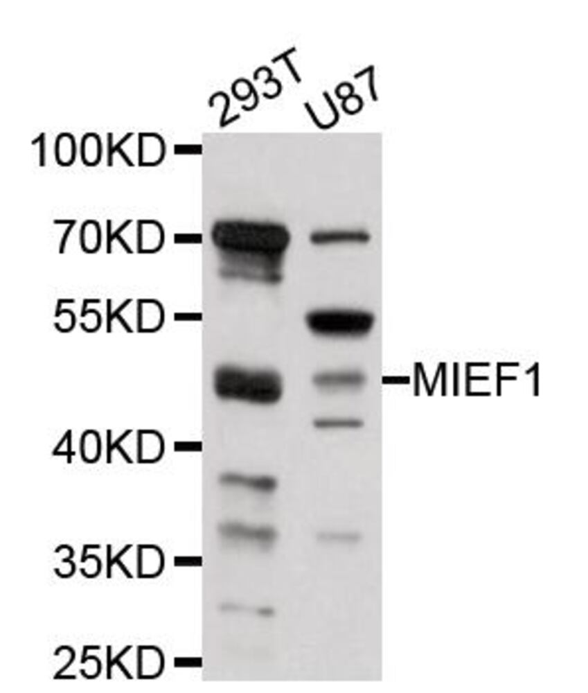 Anti-MIEF1 Antibody, 100 µl - Luminix Health