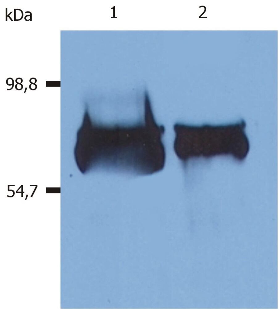 A-Hum Serum Albumin Antib [AL-01], 100 µg - Luminix Health