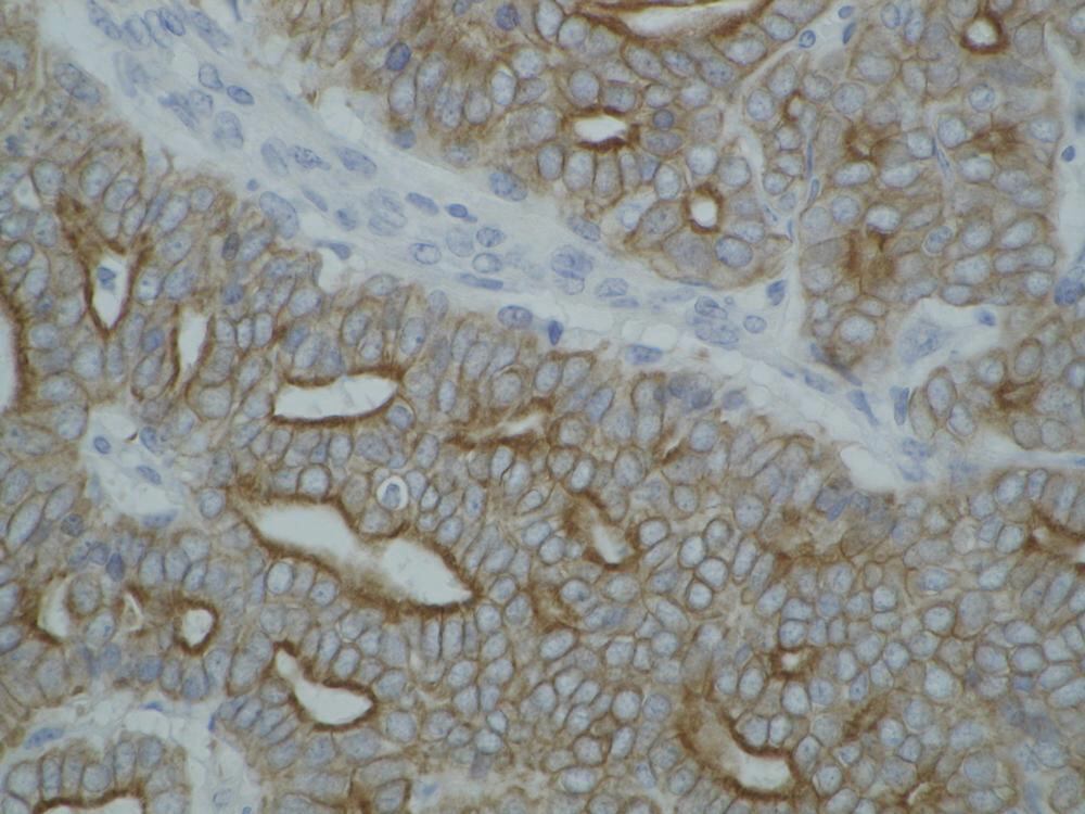 Anti-pan Cytokeratin Antibody [C-11], 100 µg - Luminix Health