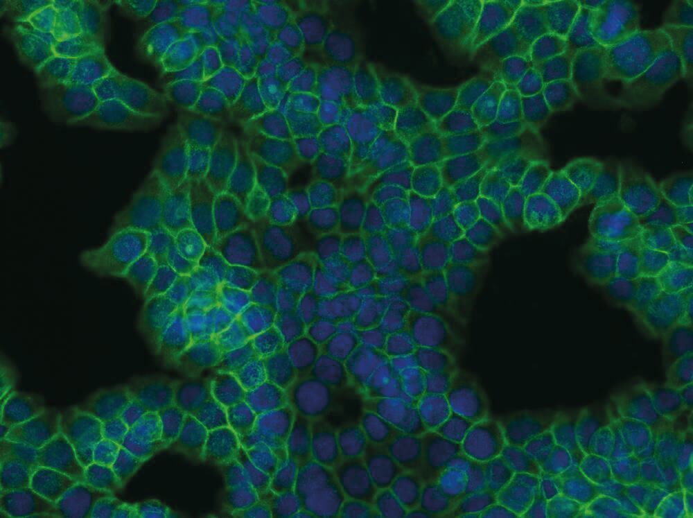Anti-beta Catenin Antibody [EM-22], 100 µg - Luminix Health