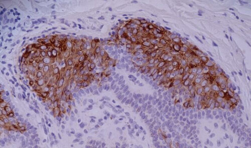 Anti-Cytokeratin 10 Antibody [VIK-10], 100 µg - Luminix Health