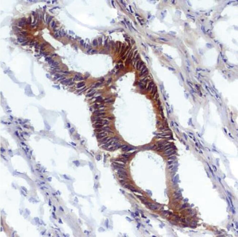 Anti-Nitrotyrosine Antibody [EM-30], 100 µg - Luminix Health
