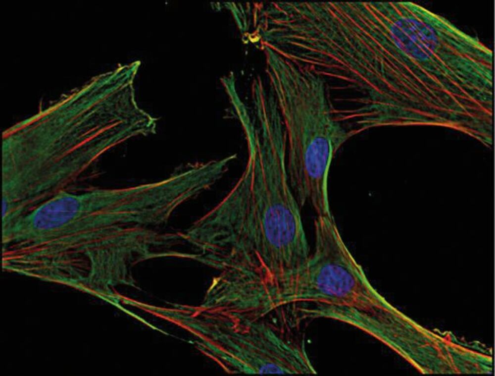Anti-Clathrin Heavy Chain Antib [BF-06], 100 µg - Luminix Health
