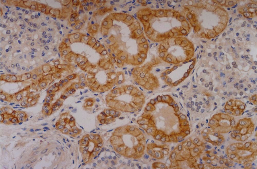 Anti-Cytokeratin 18 Antibody [C-04], 100 µg - Luminix Health
