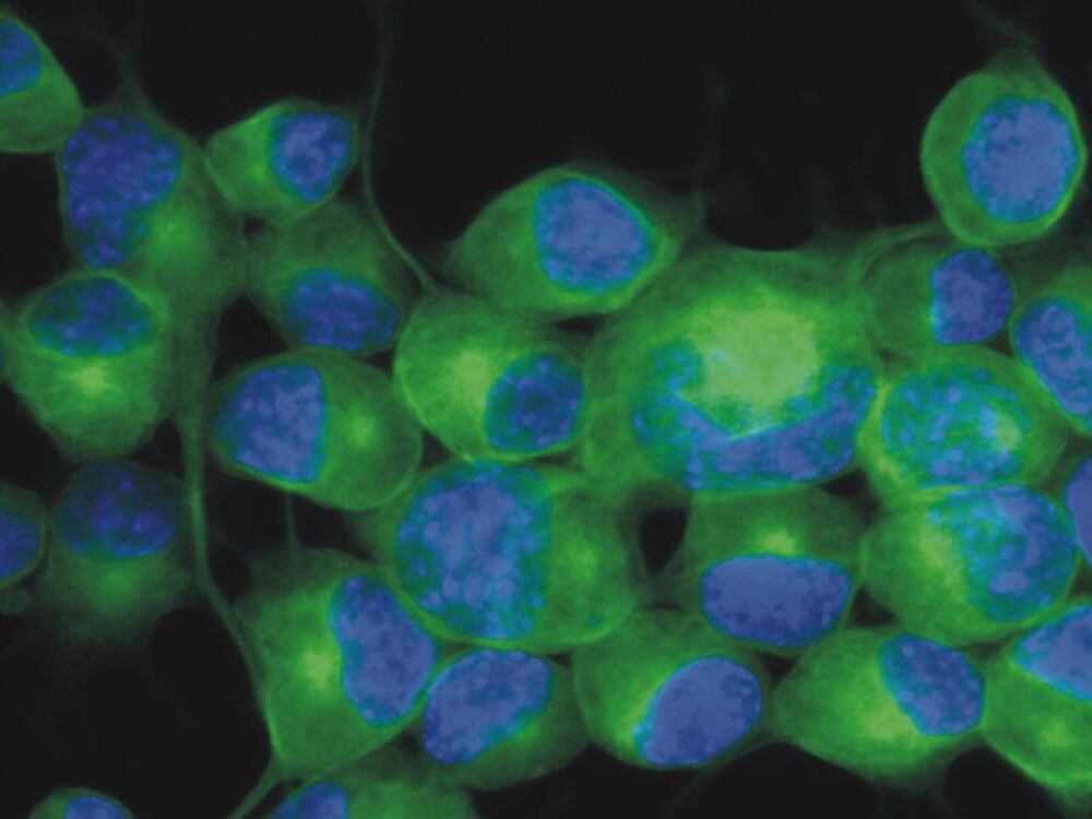Anti-beta III Tubulin Antibody [TU-20], 100 µg - Luminix Health