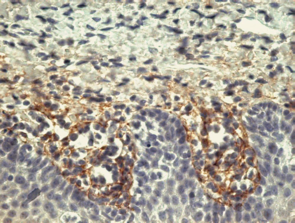 Anti-Tenascin C Antibody [T2H5], 100 µg - Luminix Health
