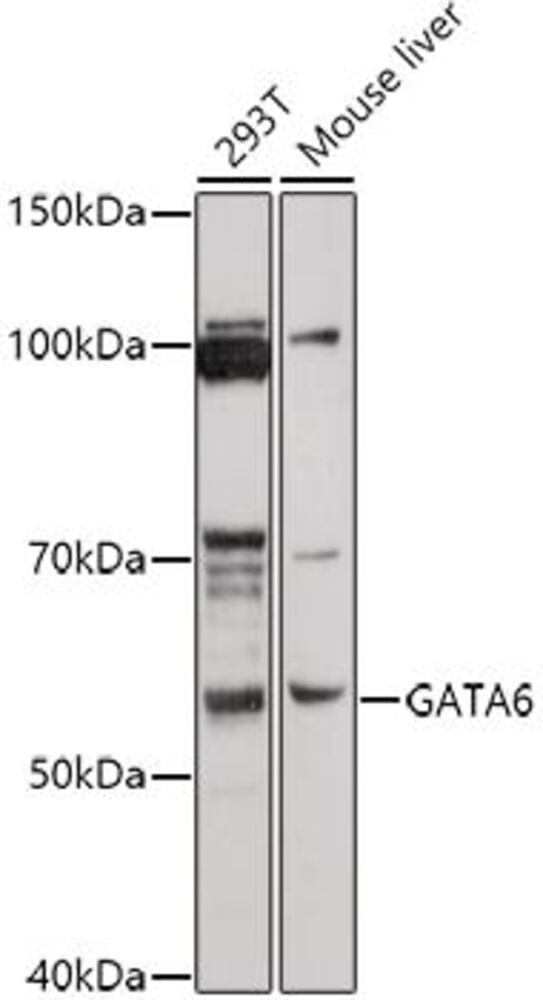 Anti-Gata6 Antibody, 100 µl - Luminix Health