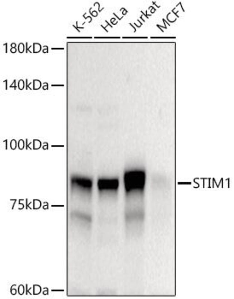 A-Stromal interaction molecule 1 Antib, 100 µl - Luminix Health