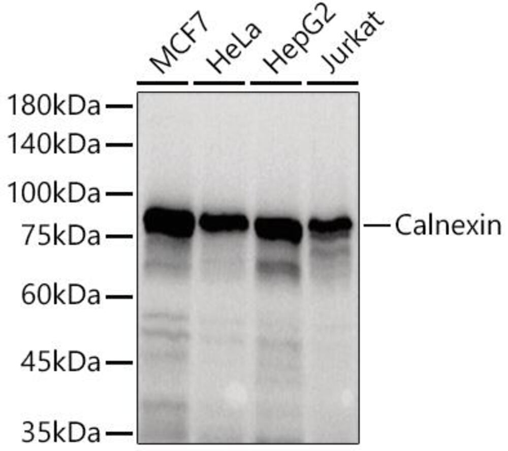 Anti-Calnexin Antibody, 100 µl - Luminix Health