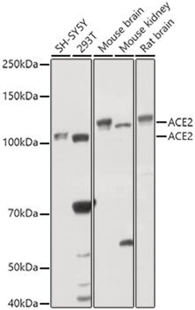 Anti-ACE2 Antibody, 100 µl - Luminix Health