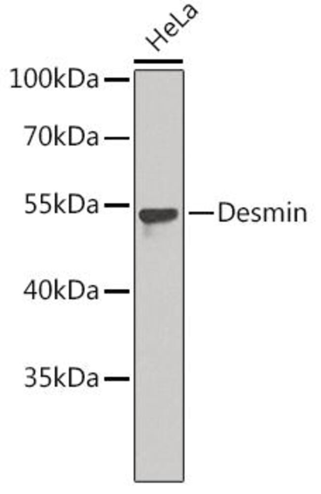 Anti-Desmin Antibody, 100 µl - Luminix Health