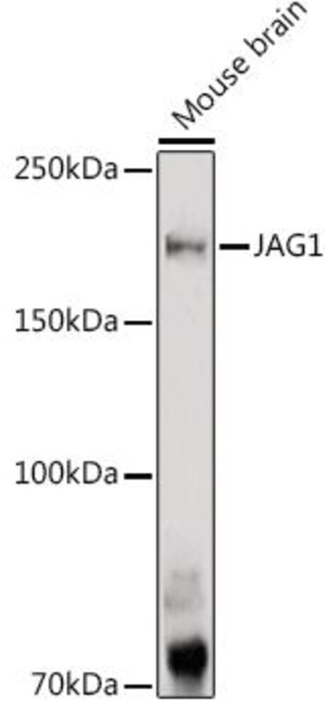 Anti-Jagged1 Antibody, 100 µl - Luminix Health