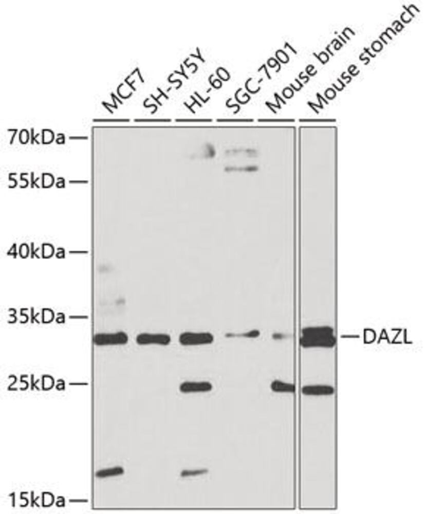Anti-DAZL Antibody, 100 µl - Luminix Health