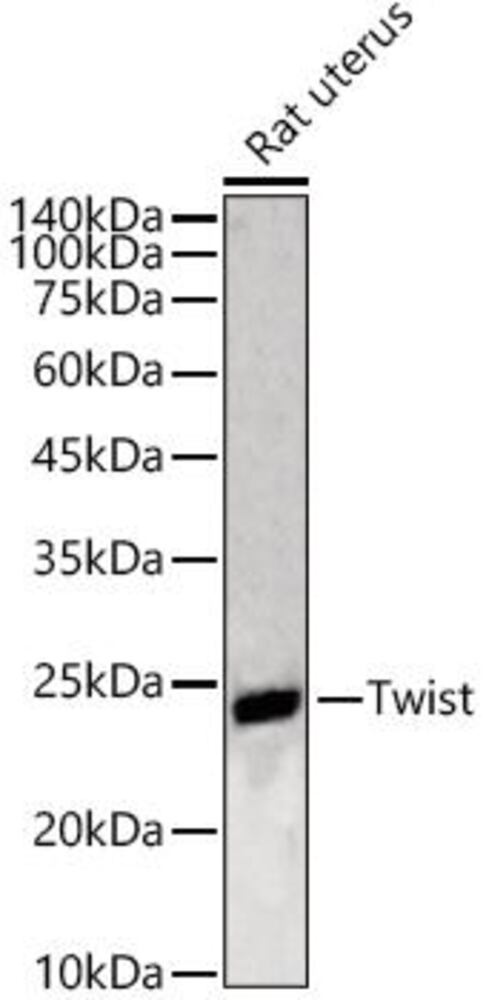 Anti-Twist Antibody, 100 µl - Luminix Health