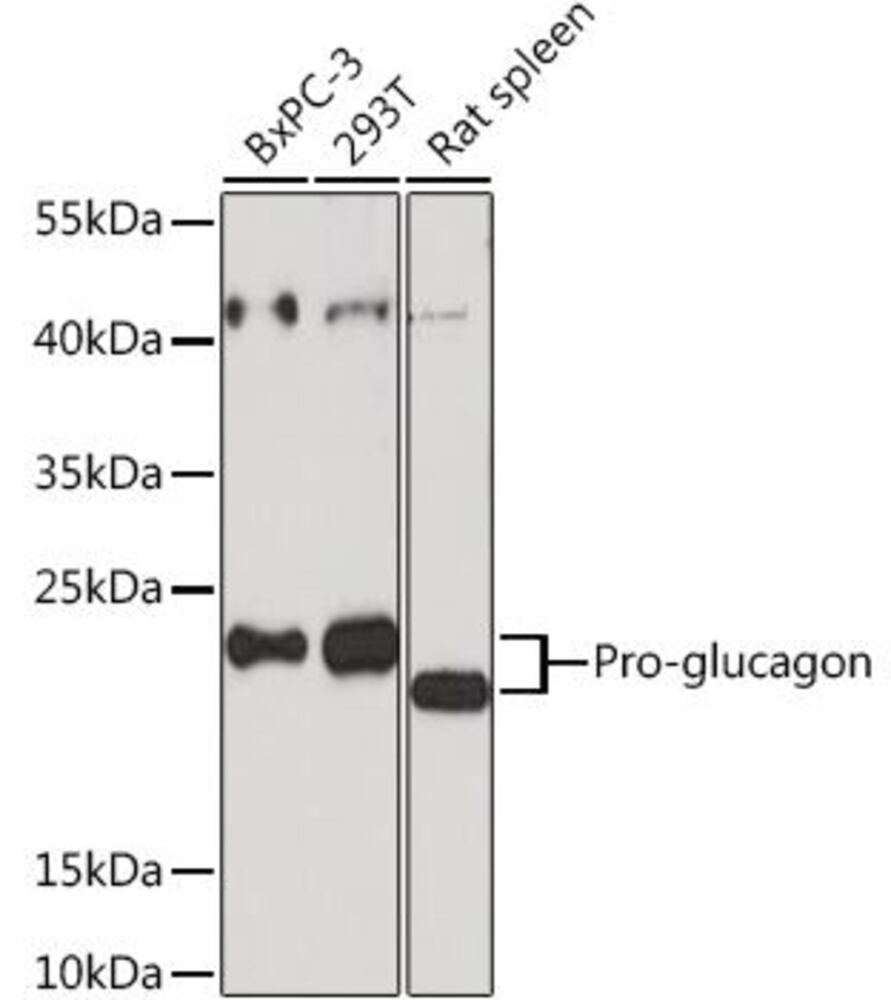 Anti-Glucagon Antibody, 100 µl - Luminix Health