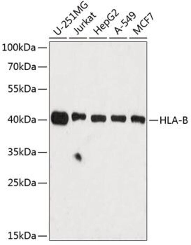 Anti-HLA Class 1 ABC Antibody, 100 µl - Luminix Health