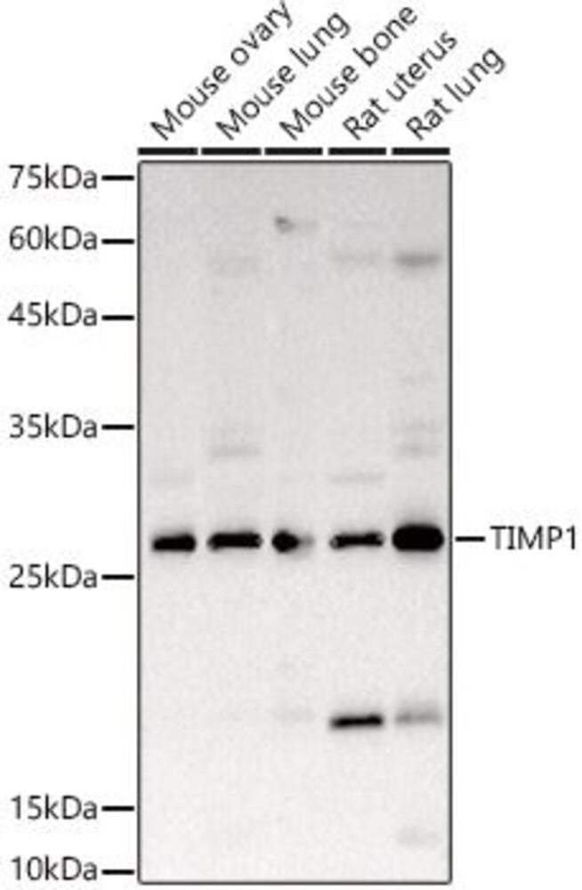 Anti-TIMP1 Antibody, 100 µl - Luminix Health