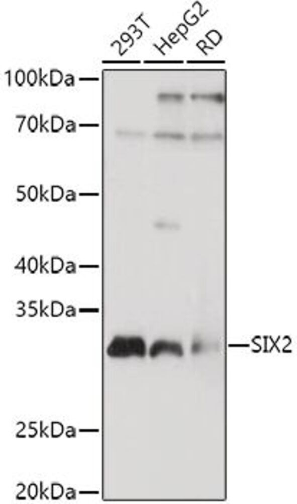 Anti-SIX2 Antibody, 100 µl - Luminix Health