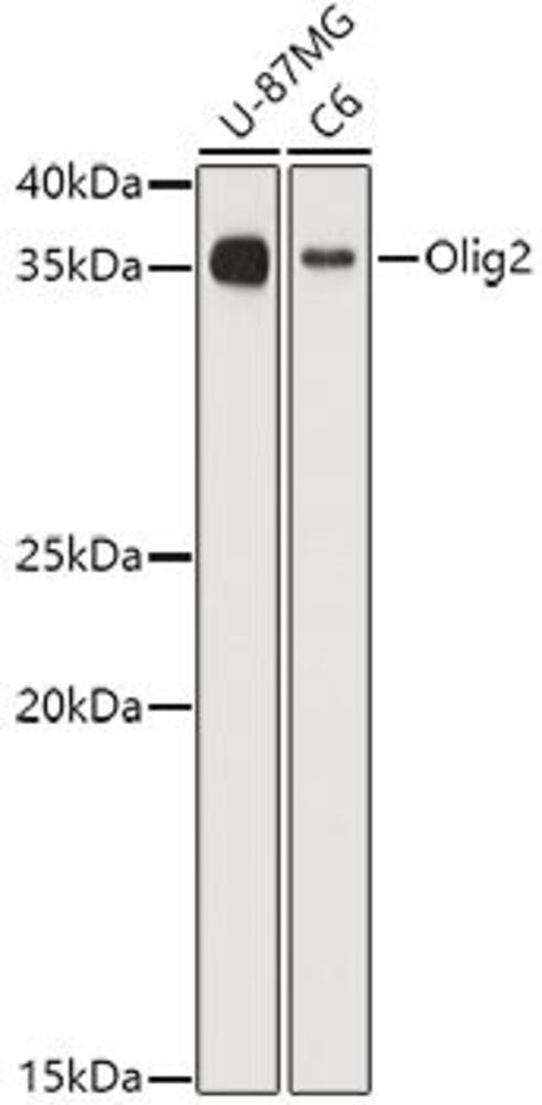 Anti-Olig2 Antibody, 100 µl - Luminix Health