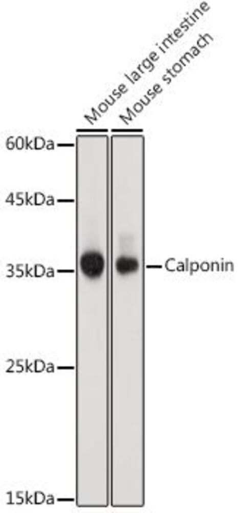 Anti-Calponin 1 Antibody, 100 µl - Luminix Health