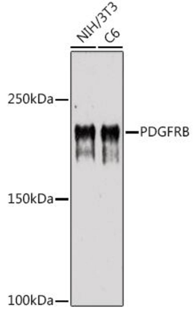 Anti-PDGFR beta Antibody, 100 µl - Luminix Health