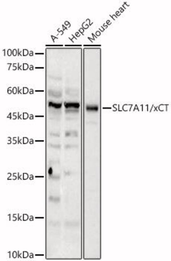 Anti-xCT Antibody, 100 µl - Luminix Health