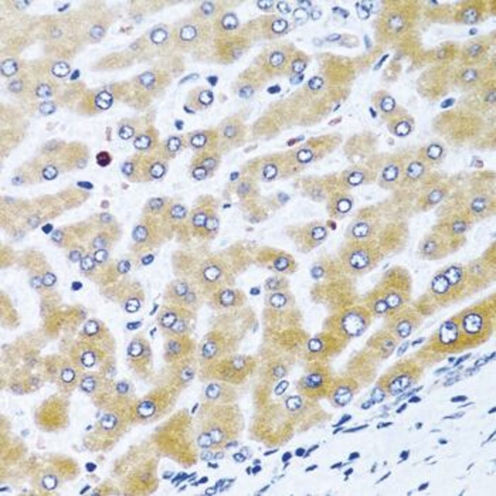 Anti-CCL21 Antibody, 100 µl - Luminix Health
