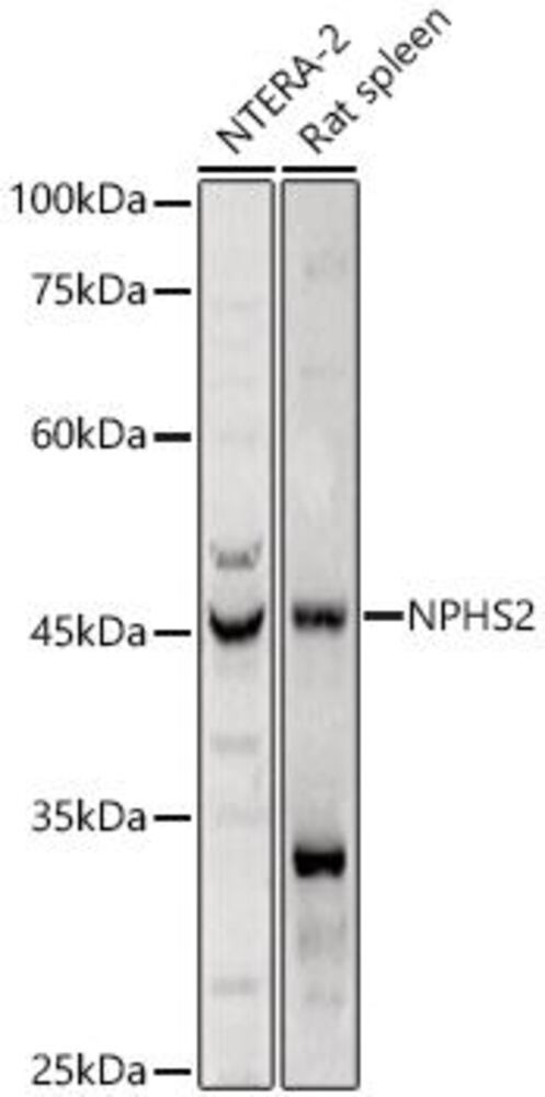 Anti-NPHS2 Antibody, 100 µl - Luminix Health