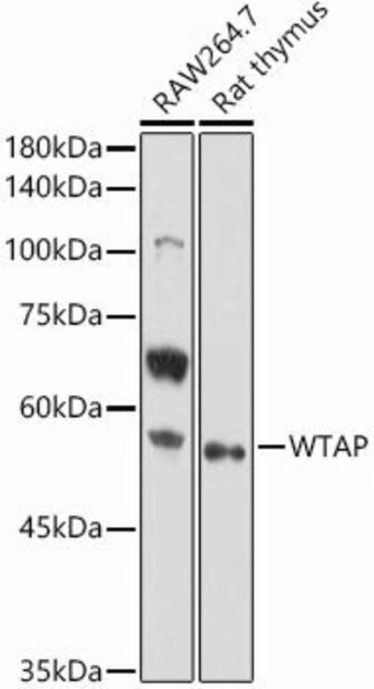 Anti-WTAP Antibody, 100 µl - Luminix Health