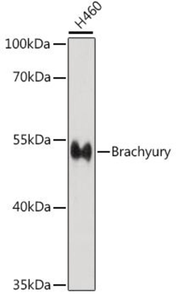Anti-Brachyury / Bry Antibody, 100 µl - Luminix Health
