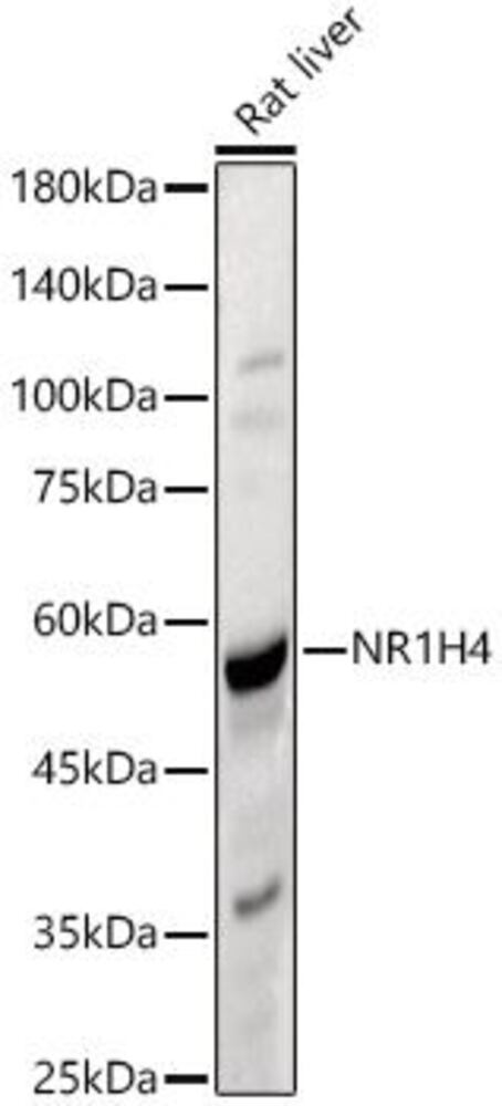 Anti-Bile Acid Receptor NR1H4 Antibody, 100 µl - Luminix Health