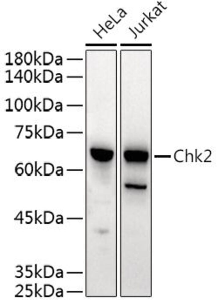 Anti-Chk2 Antibody, 100 µl - Luminix Health