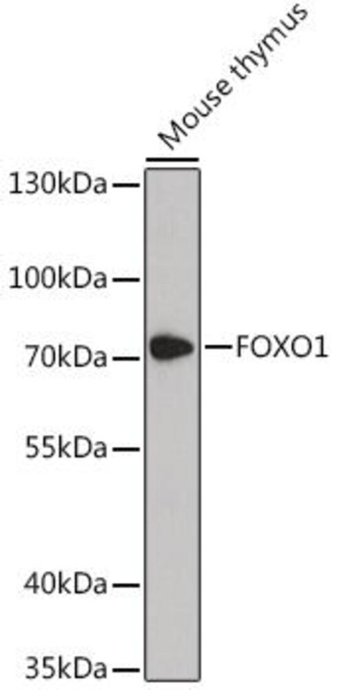 Anti-FOXO1A Antibody, 100 µl - Luminix Health