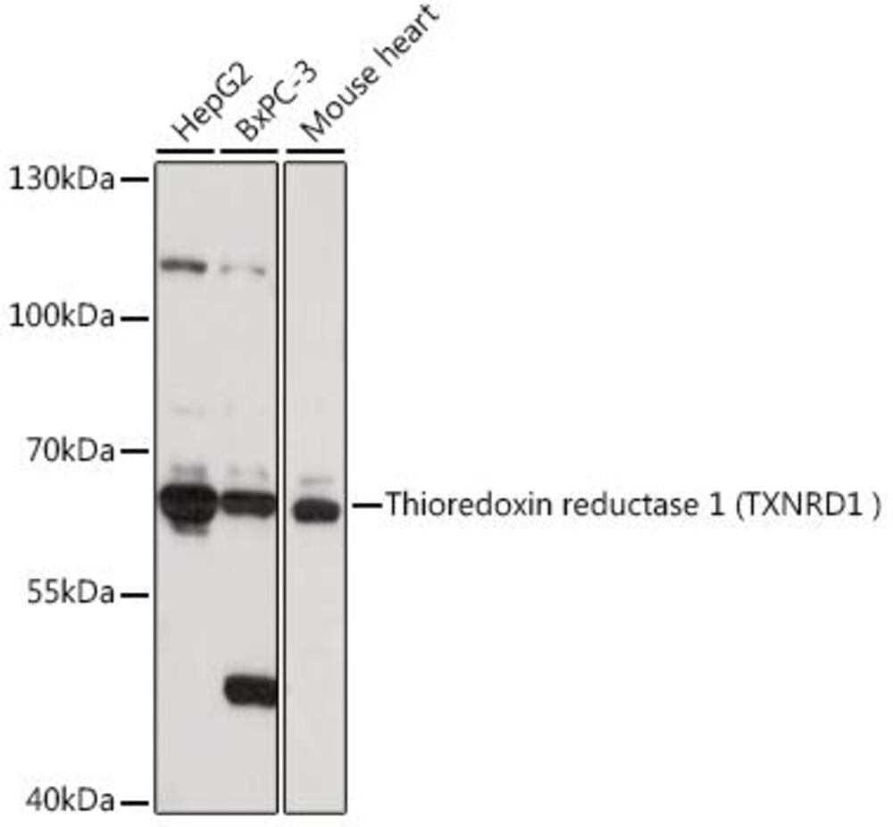 Anti-TXNRD1 Antibody, 100 µl - Luminix Health