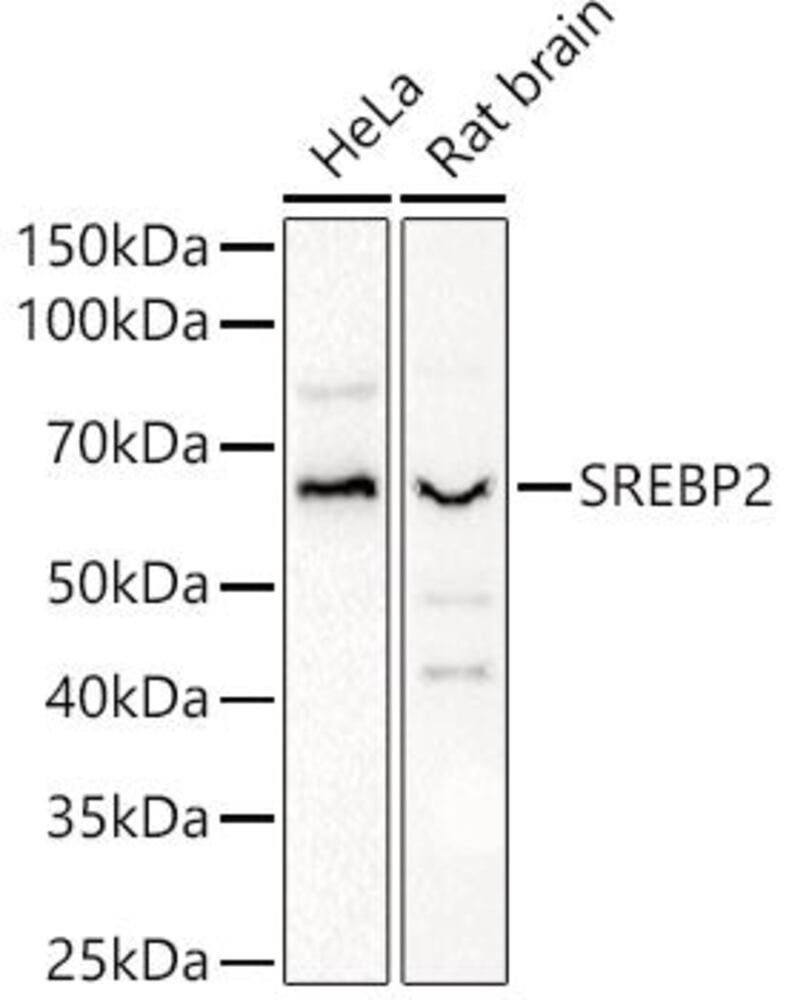 Anti-SREBP2 Antibody, 100 µl - Luminix Health