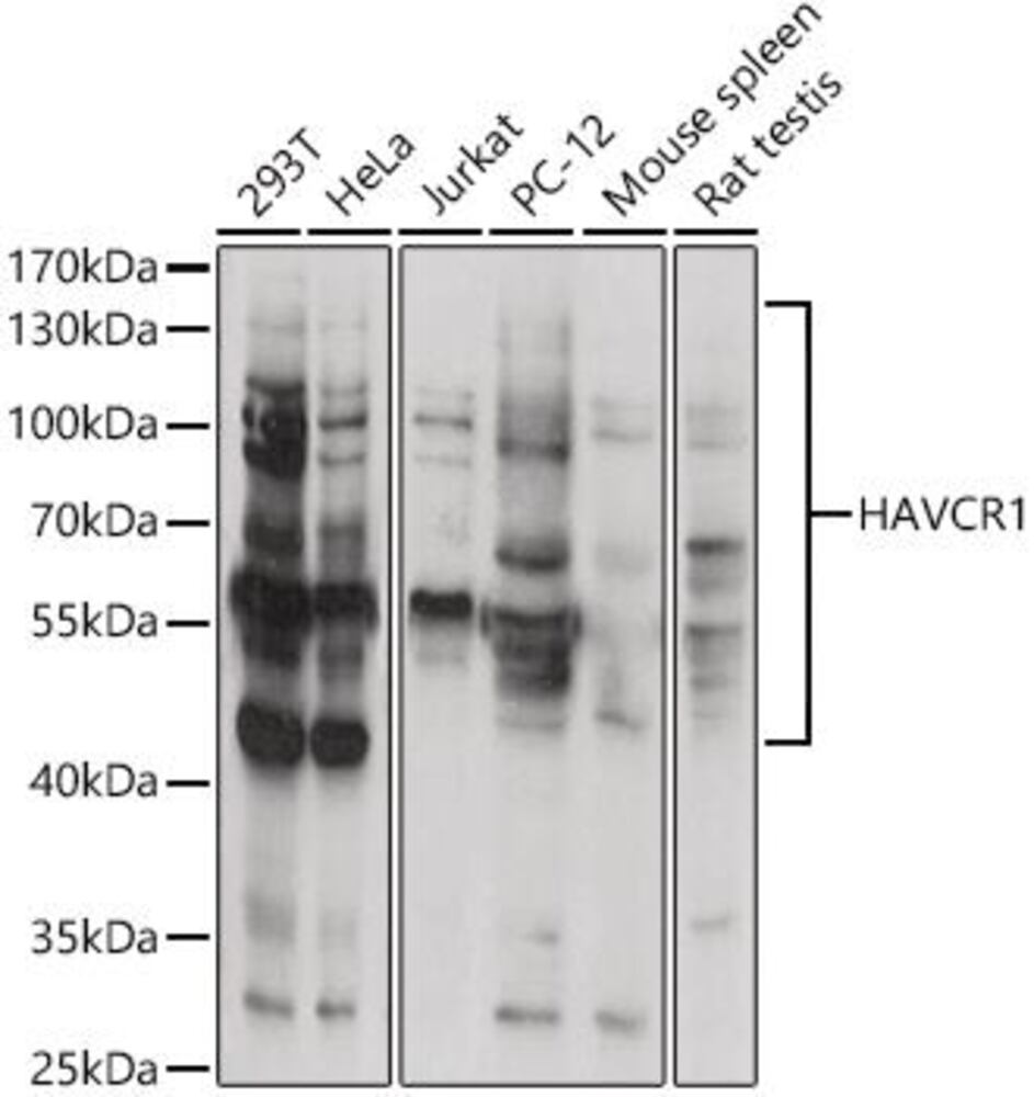 Anti-TIM 1 Antibody, 100 µl - Luminix Health