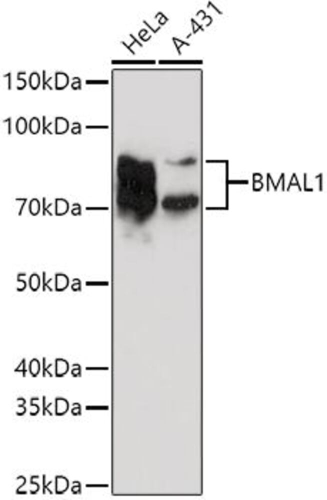 Anti-BMAL1 Antibody, 100 µl - Luminix Health