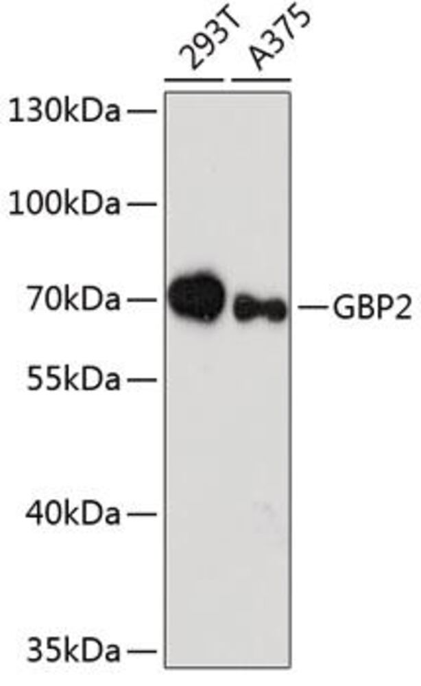 Anti-GBP2 Antibody, 100 µl - Luminix Health