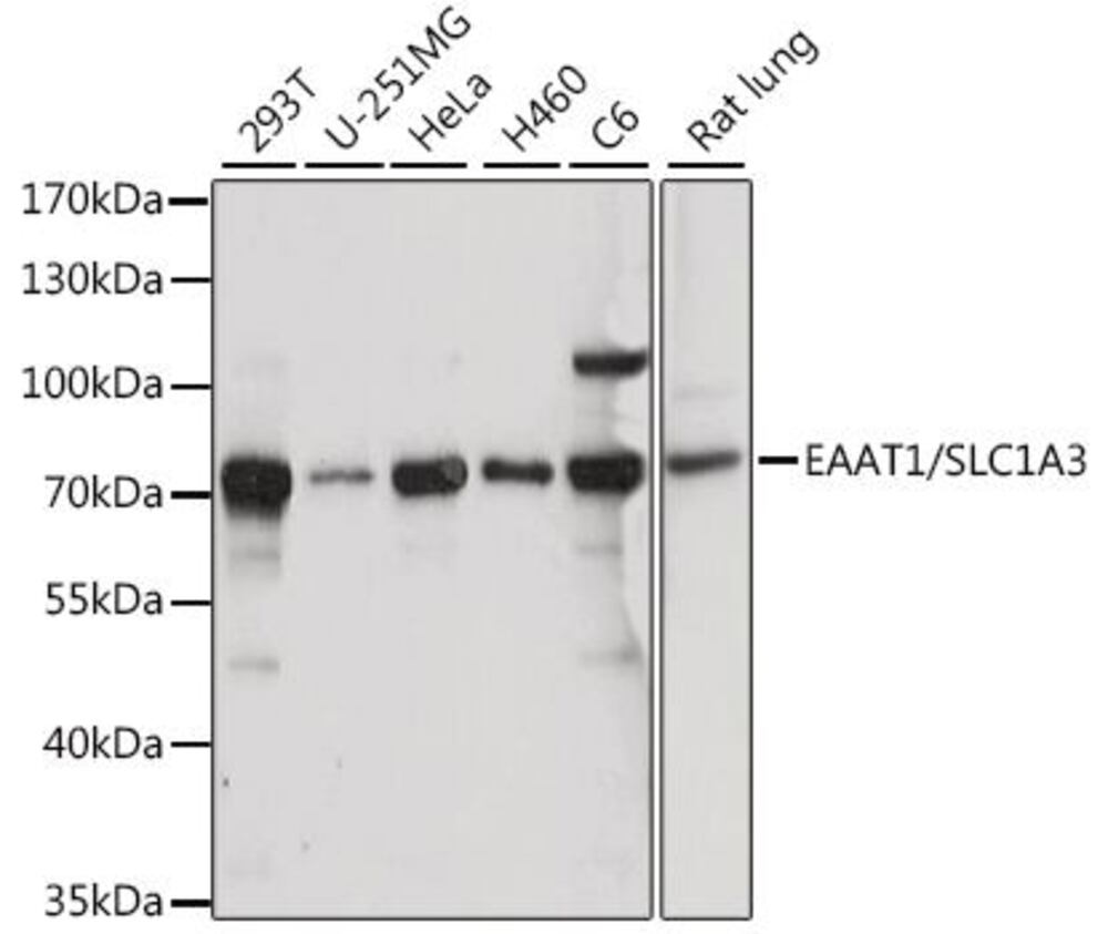 Anti-EAAT1 Antibody, 100 µl - Luminix Health