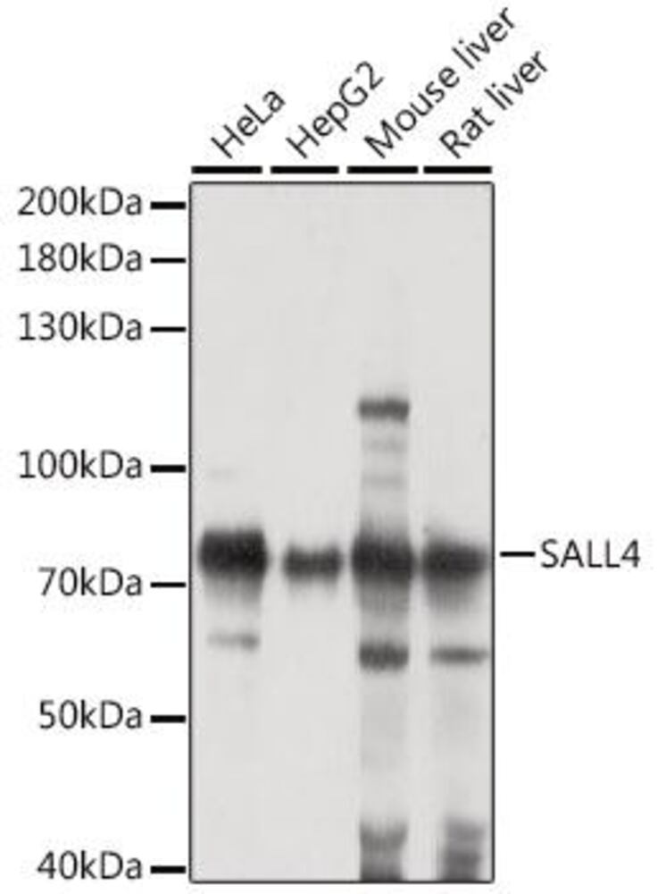 Anti-Sall4 Antibody, 100 µl - Luminix Health