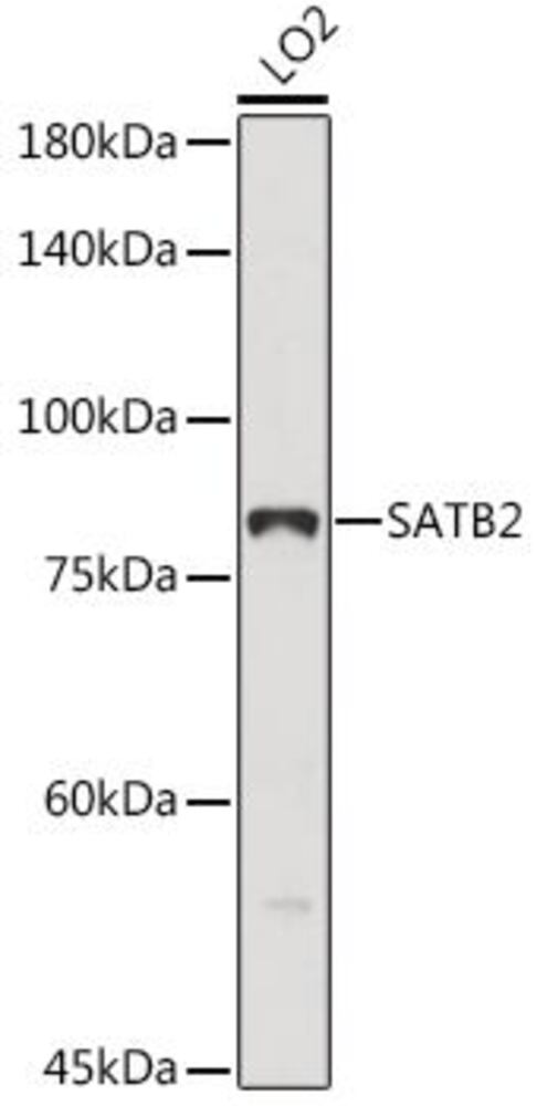 Anti-SATB2 Antibody, 100 µl - Luminix Health