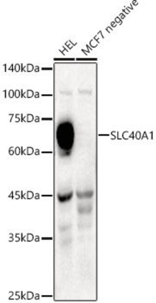 Anti-SLC40A1 Antibody, 100 µl - Luminix Health