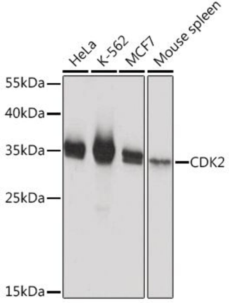 Anti-CDK2 Antibody, 100 µl - Luminix Health