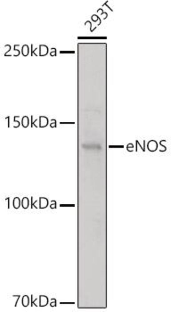 Anti-eNOS Antibody, 100 µl - Luminix Health
