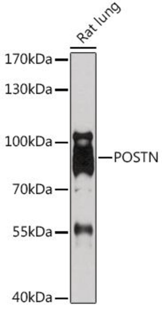 Anti-Periostin Antibody, 100 µl - Luminix Health