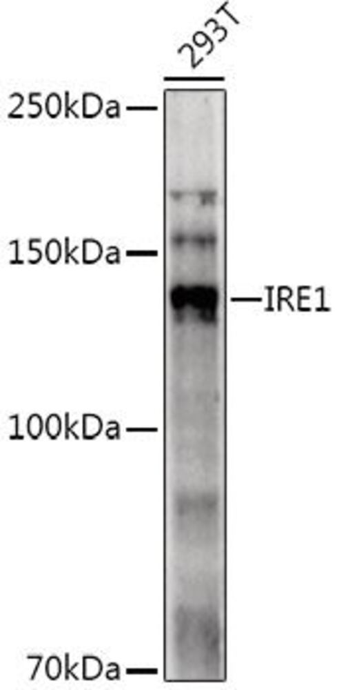 Anti-IRE1 Antibody, 100 µl - Luminix Health